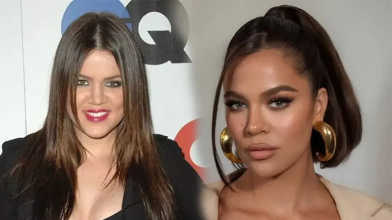 Khloe Kardashian'ın Şok Eden Estetik Değişimi! Yok Artık Diyeceksiniz
