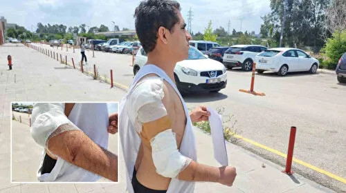 Hastane yolunda sahipsiz köpek saldırdı