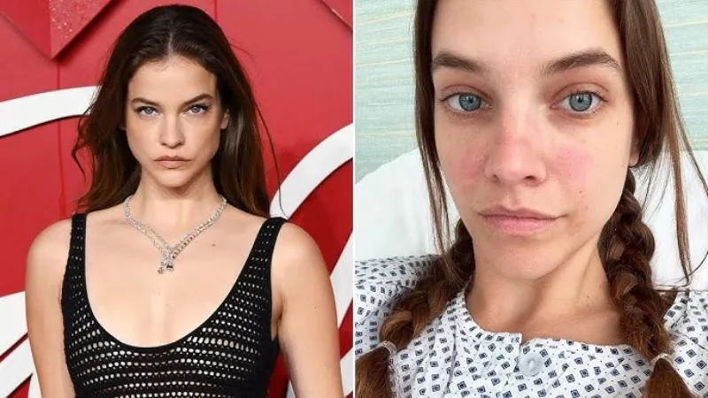 Barbara Palvin'in Şok Hastalığı! Modellik Kariyeri Tehlikede mi?